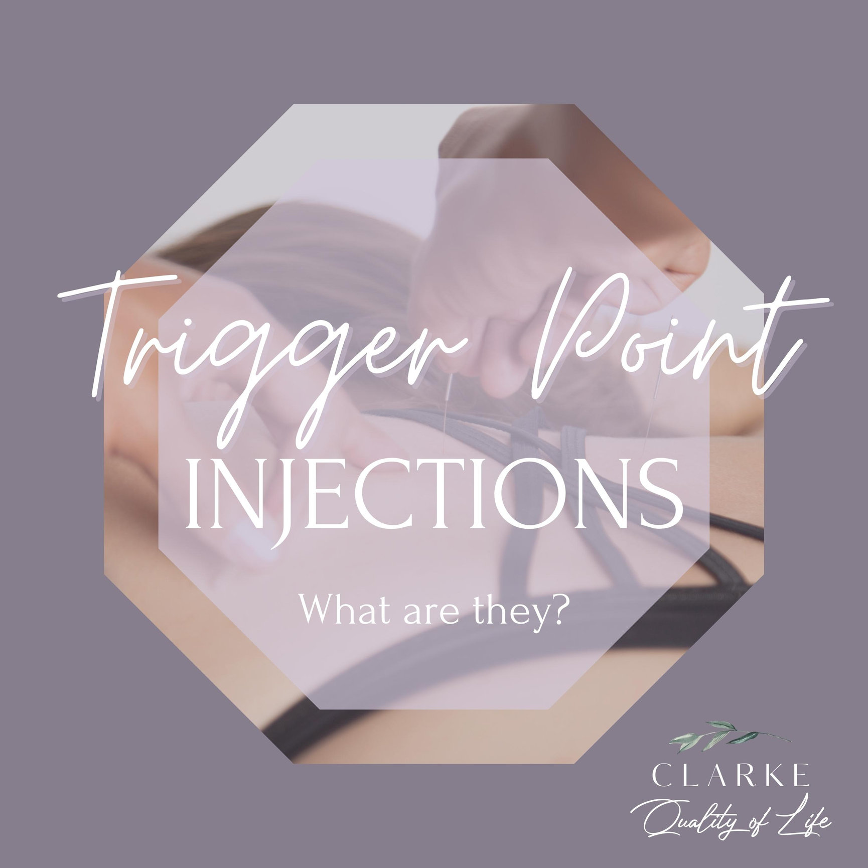 Trigger Point Injections In Fort Worth Texas Quality Of Life