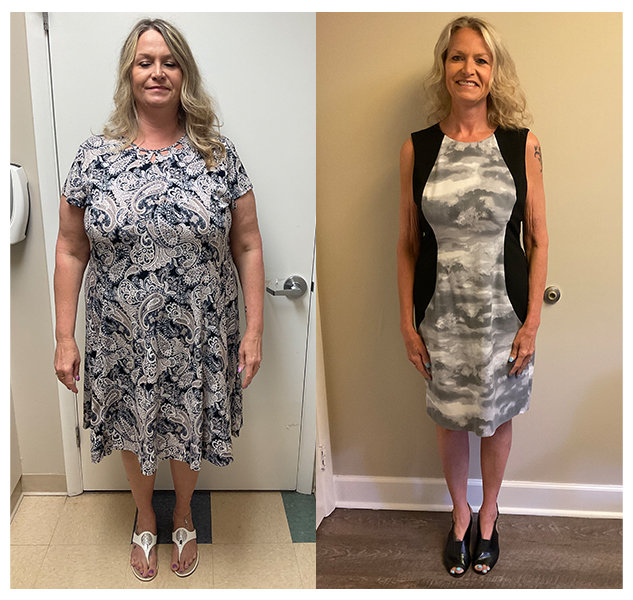 Charlene's Weight Loss Transformation