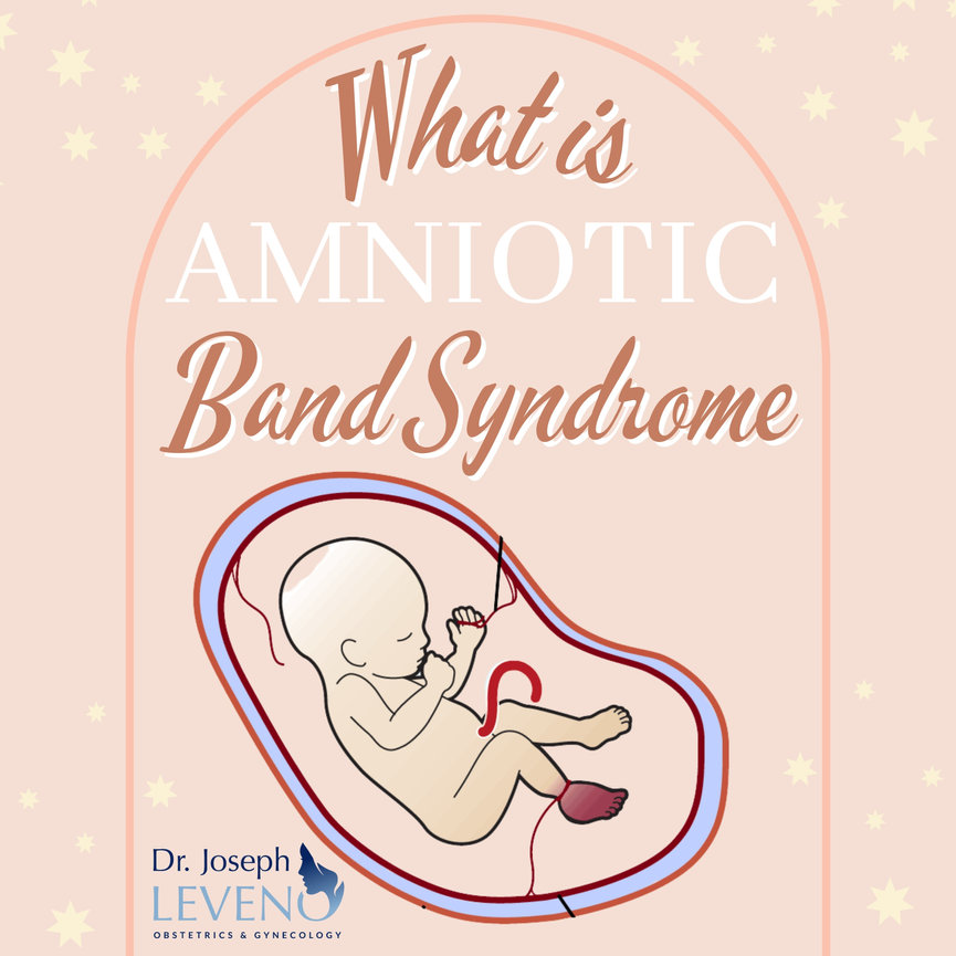 What Is Amniotic Band Syndrome Dr Joseph Leveno 6667