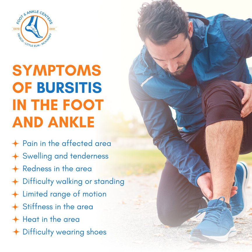 Signs and symptoms of Bursitis of Foot and Ankle in Frisco, Little Elm ...