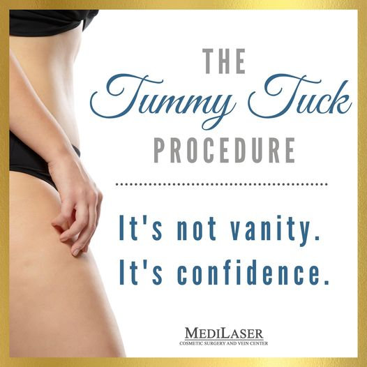 Tummy-Tuck-Ab-Definition-Procedure - Medilaser Surgery and Vein Center