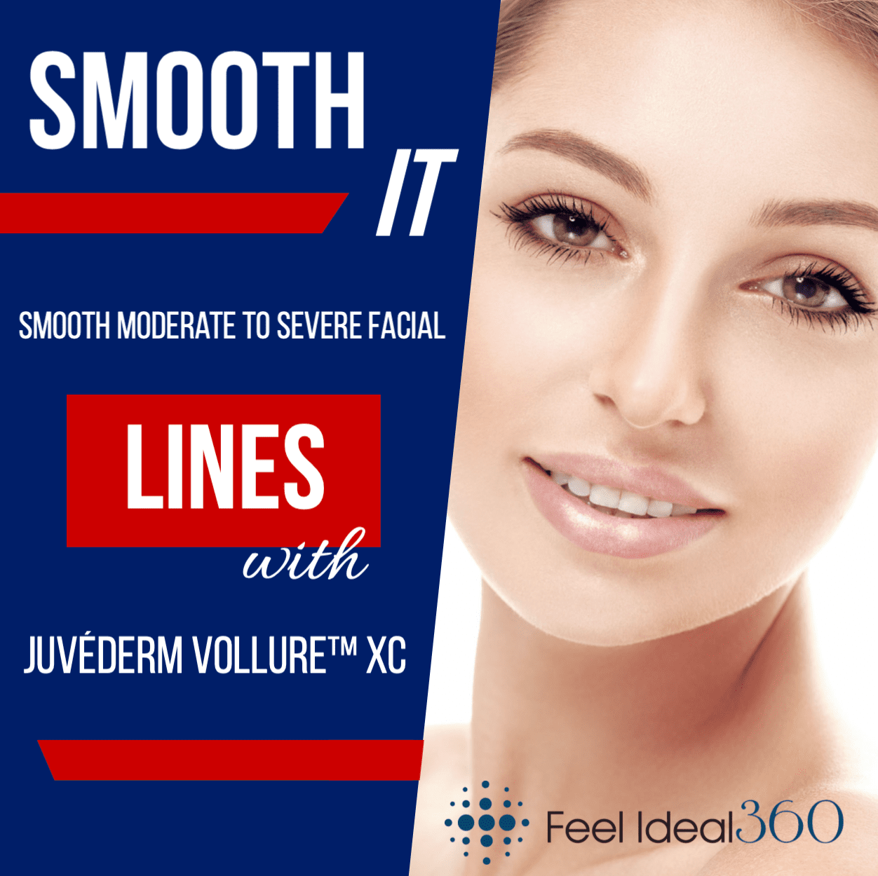 JUVEDERM-VOLLURE-FILLER-WRINKLE-FINE-LINES-SOUTHLAKE-TEXAS-FEEL-IDEAL